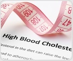 ESC and EAS release new dyslipidaemia guidelines