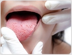 Can oral bacteria make heart disease worse?