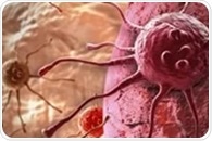 A Molecular Magnifying Glass for Tracking Protein Misfolding in Living Cells