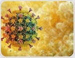 Generative AI Flags Hidden Bird Flu Risks In Patient Records With Speed And Accuracy