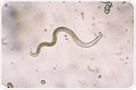 Parasitic worm evades detection by suppressing skin neurons