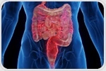 New insights into pathogenic T cells offer hope for Crohn's disease treatment