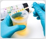 Study uncovers widespread ignorance of cystitis and UTI prevention