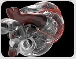 MRI and 3D printing reveal how artificial hearts manage blood flow