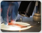 Thousands of ‘healthy’ Brits are unknowingly low on iron