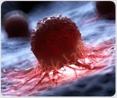 New drug combination could delay the progression of advanced prostate cancer