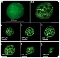 3D fluorescence microscopy explores the molecular basis of cancer metastasis