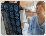 Can the gut microbiome adapt to protect the brain after stroke?