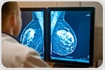 Whole genome sequencing may guide care for thousands of breast cancer patients