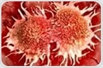 Breakthrough combo therapy lowers death risk in recurrent prostate cancer