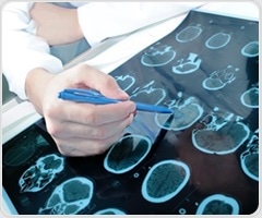 New European trial tests subcutaneous EEG technology for people with epilepsy