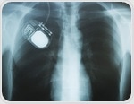 Smart implants and closed-loop systems: The next generation of therapeutic devices