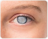 Revolutionizing cataract surgery with office-based oral sedation