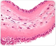 Understanding the role of m6A methylation in acute lung injury pathogenesis