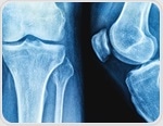 Yogurt’s impact on bone health falls short of fracture protection, review finds