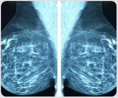 New radioimmunotherapy approach shows potential to cure HER2-positive breast cancer