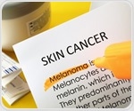 Researchers develop multiethnic model for identifying individuals with skin cancer