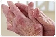 Rockefeller scientists engineer next-generation antibody to replace IVIG therapy