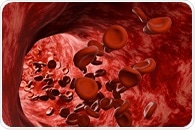 Noninvasive optical system measures blood flow with precision