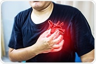 Common gout drug shows promise in preventing heart attacks and strokes