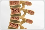 Adipose tissue stem cells show promise in treating osteoporotic vertebral fractures