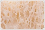 Breakthrough in bone regeneration using nanoparticle-stem cell hybrid