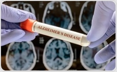 AI tool offers early warning system for dementia—years before symptoms begin