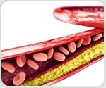 New initiative boosts cholesterol control in veterans with heart and blood vessel disease