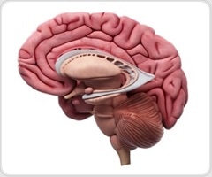 Clogged brain drains may signal early Alzheimer's risk