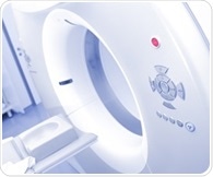 AI repurposes routine CT scans to detect hidden bone loss