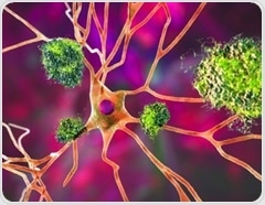 Arginine slows amyloid buildup and improves brain outcomes in Alzheimer’s disease models