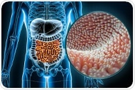 Global data show why gut microbiomes in industrialized regions look increasingly alike