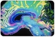 Researchers use "zap-and-freeze" technique to watch hard-to-see brain cell communications