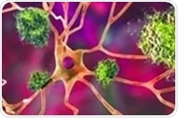 Arginine slows amyloid buildup and improves brain outcomes in Alzheimer’s disease models