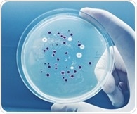 Toxin-secreting gut bacterium emerges as a driver of ulcerative colitis