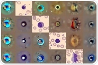 AI Detects Abnormal Blood Cells More Accurately and Knows When to Ask for Help