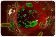 Intravenous iron shows safe and beneficial outcomes for patients with bacterial infection and anemia