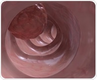 Integrating AI into colon cancer diagnosis improves the speed and accuracy of detection