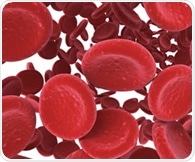 Intravenous iron shows safe and beneficial outcomes for patients with bacterial infection and anemia