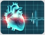 Study reveals the hidden toll of sudden cardiac death in type 1 and type 2 diabetes