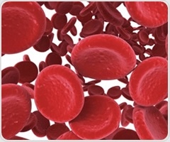 Intravenous iron shows safe and beneficial outcomes for patients with bacterial infection and anemia