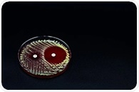 Multifunctional Nanogels: A Breakthrough in Antibacterial Strategies