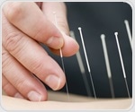 Acupuncture improves breast cancer survivors' perceived cognitive impairment