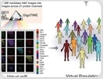 AI turns routine pathology slides into powerful maps of the tumor immune landscape