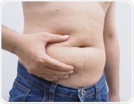 Metabolic syndrome affects nearly four in ten US adults as rates climb in older and Black populations