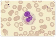 Researchers identify chromatin accessibility changes driving stem cell transformation in MDS