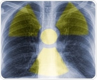 Global nuclear medicine organizations unite to standardize quantitative PET imaging