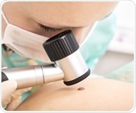 Using contrast-enhanced ultrasound to distinguish hepatic PEComa from HCC without high-risk factors