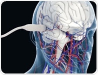 Understanding key differences between conventional and functional ultrasound