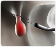 Bowel preparation for colonoscopies may temporarily alter gut balance, preclinical study suggests